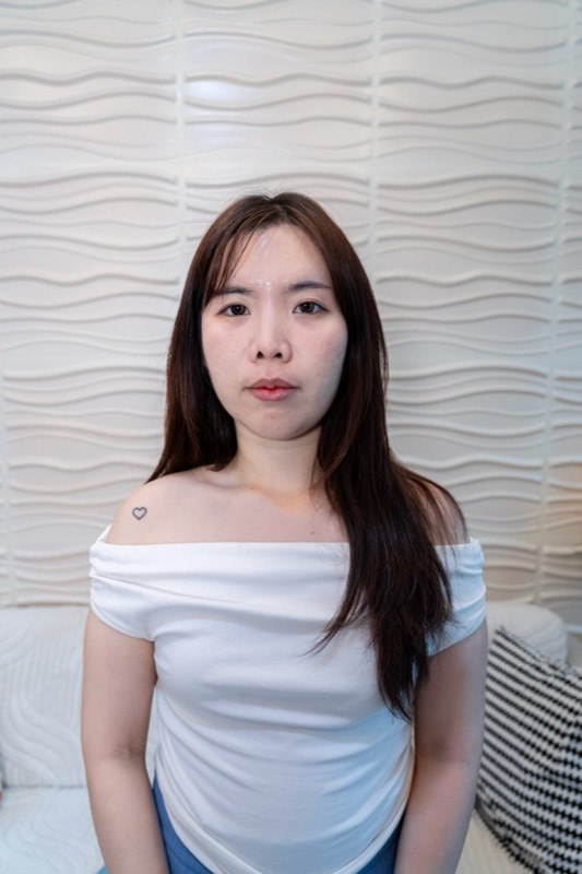 คุณปริ้น ผู้เข้ารับบริการ Lertluck Clinic